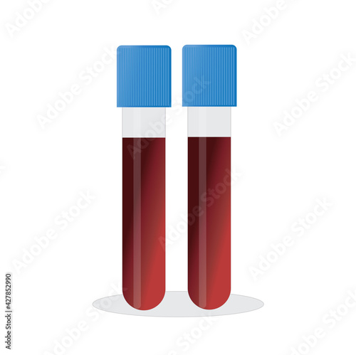 test tubes with blood and a container with urine