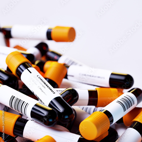 Bulk of Coronavirus blood sample test tubes with positive and negative indication on sticker