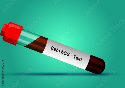 Blood sample for beta hCG hormone test. Pregnancy test. A medical testing concept with tube vector in the blue background. photo