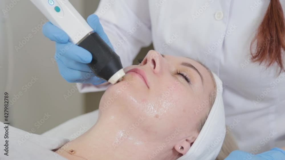 Professional beautician woman doing carboxytherapy machine on the face of a client. Professional beautician woman doing carboxytherapy machine on the face of a client.