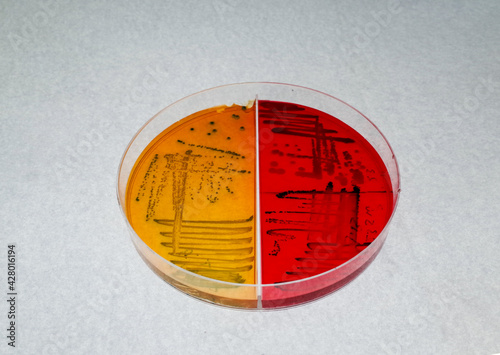 laboratory dish contain growth of colored bacterial colonies on differential agar media photo