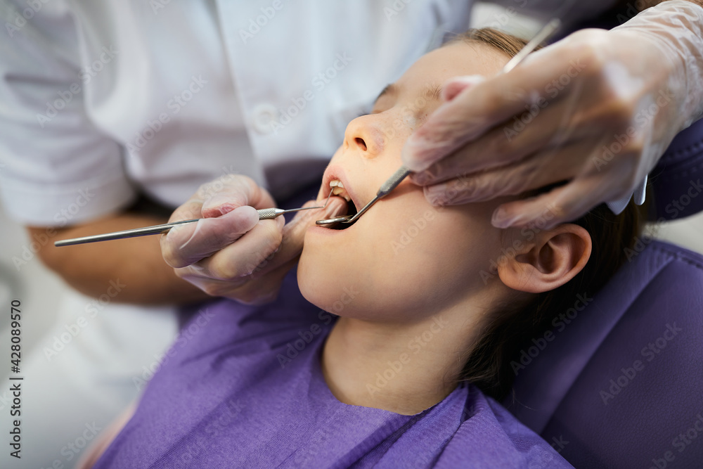 Close-up of dentist examining little girl's teeth at dentist's office.