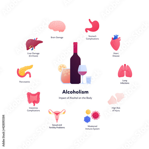 Alcoholism harm concept. Vector flat illustration. Bottle of wine, glass with alcohol cocktail and drink shot symbol. Human organ with symptom text. Design element.