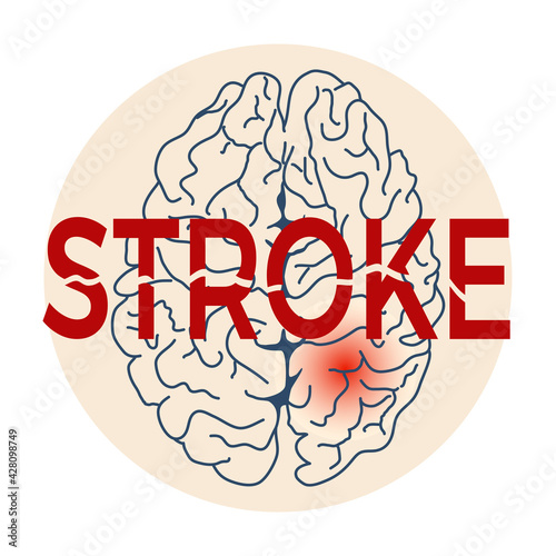 Human brain stroke in circle. Medicine, anatomy, physiology, health. Vector illustration. Healthcare poster or banner template.