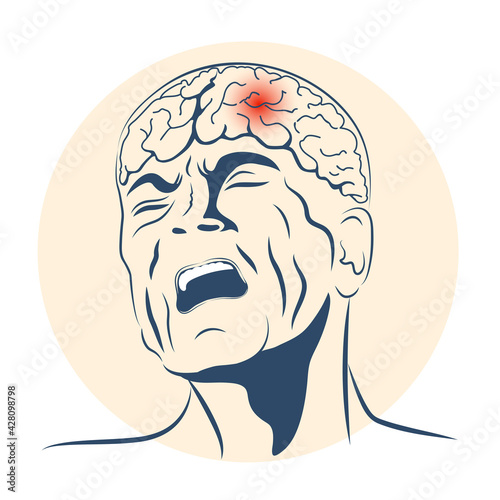 Man is in headache with grimace of anguish on his face. Suited for  ache medicine packaging. Vector illustration. Healthcare poster or banner template.