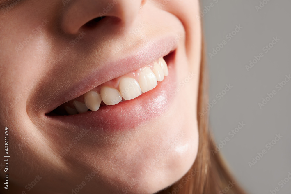 Obraz premium Close up of smiling female face with healthy straight white teeth. Joyful young woman demonstrating perfect toothy smile. Concept of dentistry, stomatology and dental care.