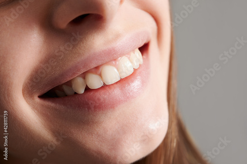 Close up of smiling female face with healthy straight white teeth. Joyful young woman demonstrating perfect toothy smile. Concept of dentistry  stomatology and dental care.