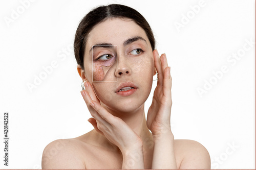 Portrait of a young beautiful woman holding her face in her hands. White background. Copy the space. The concept of epidermis renewal photo