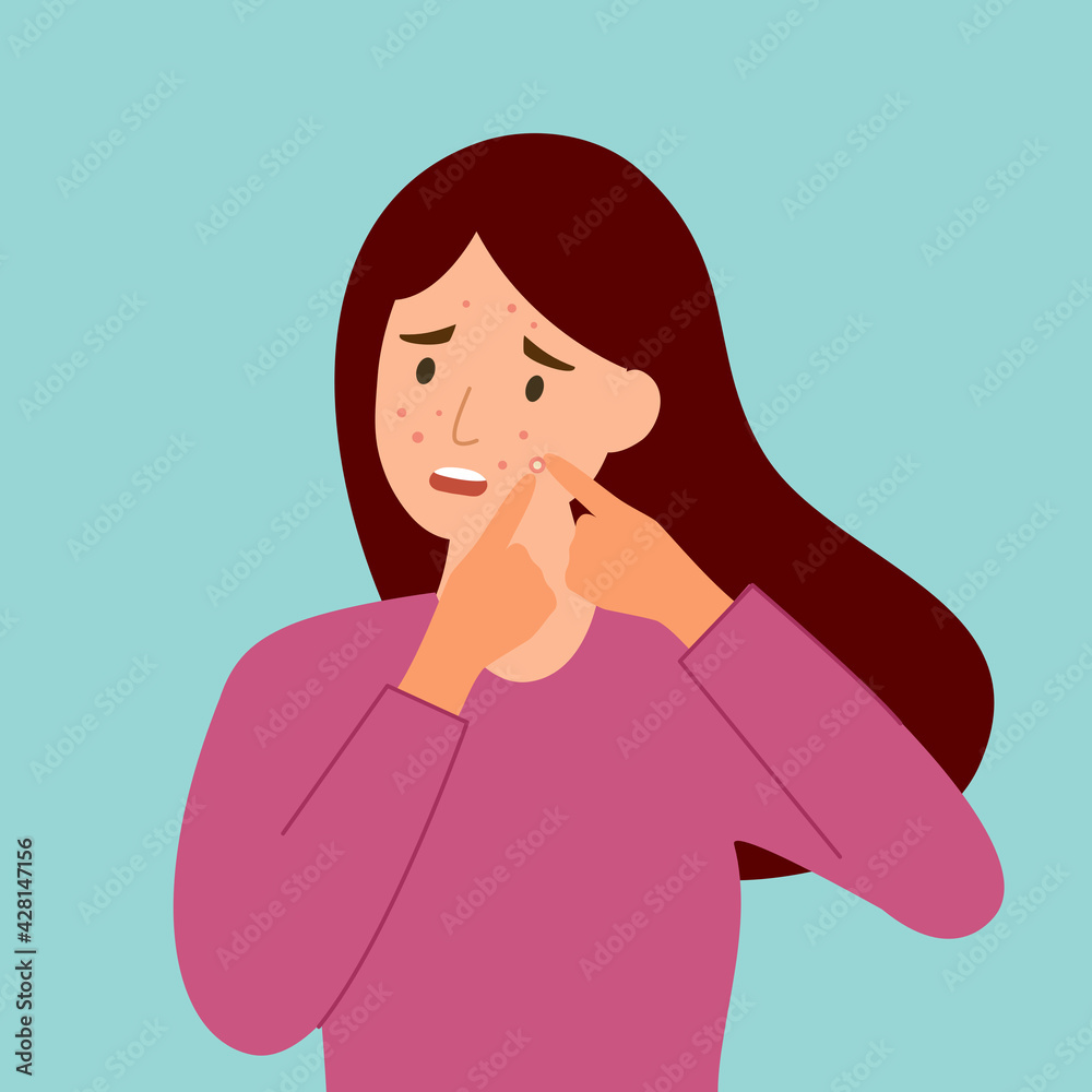 Woman squeezing and removing pimple on face in flat design. Female acne skin problem. Woman squeezing and removing pimple on face in flat design. Female acne skin problem.