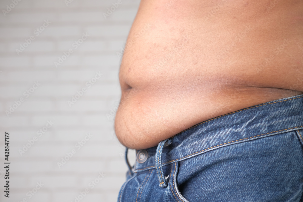 Naklejka premium young man with excessive belly fat, overweight concept