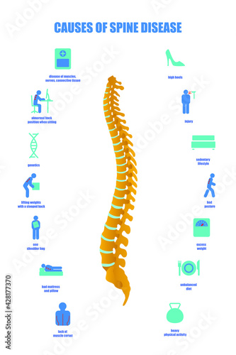 Causes of the spine disease. A set of icons on the topic of posture disorders. Medical infographics on the topic of scoliosis, lordosis, kyphosis