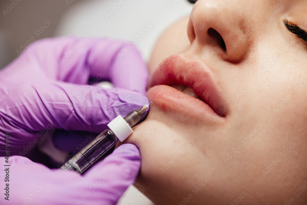 Young woman receiving a botox injection in her lips, close up