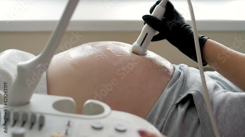 A professional female doctor with glasses makes a 3D ultrasound of the abdominal cavity of a pregnant woman in the clinic. The doctor uses ultrasound equipment when examining a pregnant woman.