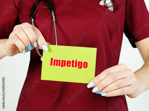 Medical concept meaning Impetigo with inscription on the piece of paper.