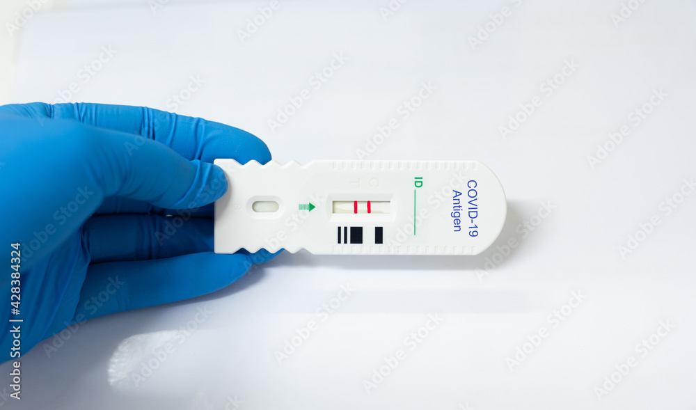 Strip Screening rapid test COVID-19 antigen positive.