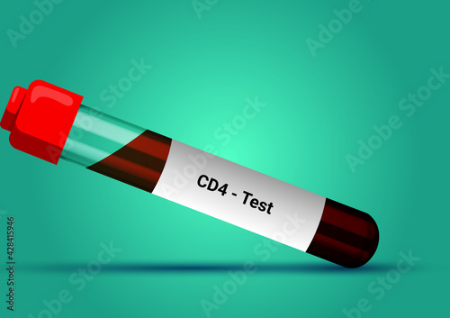 Blood sample for CD4 test. Pregnancy test. A medical testing concept with tube vector in the blue background.