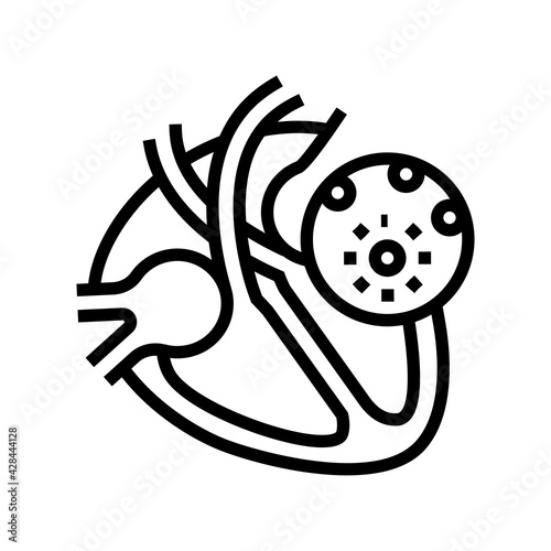 myocarditis disease line icon vector. myocarditis disease sign. isolated contour symbol black illustration