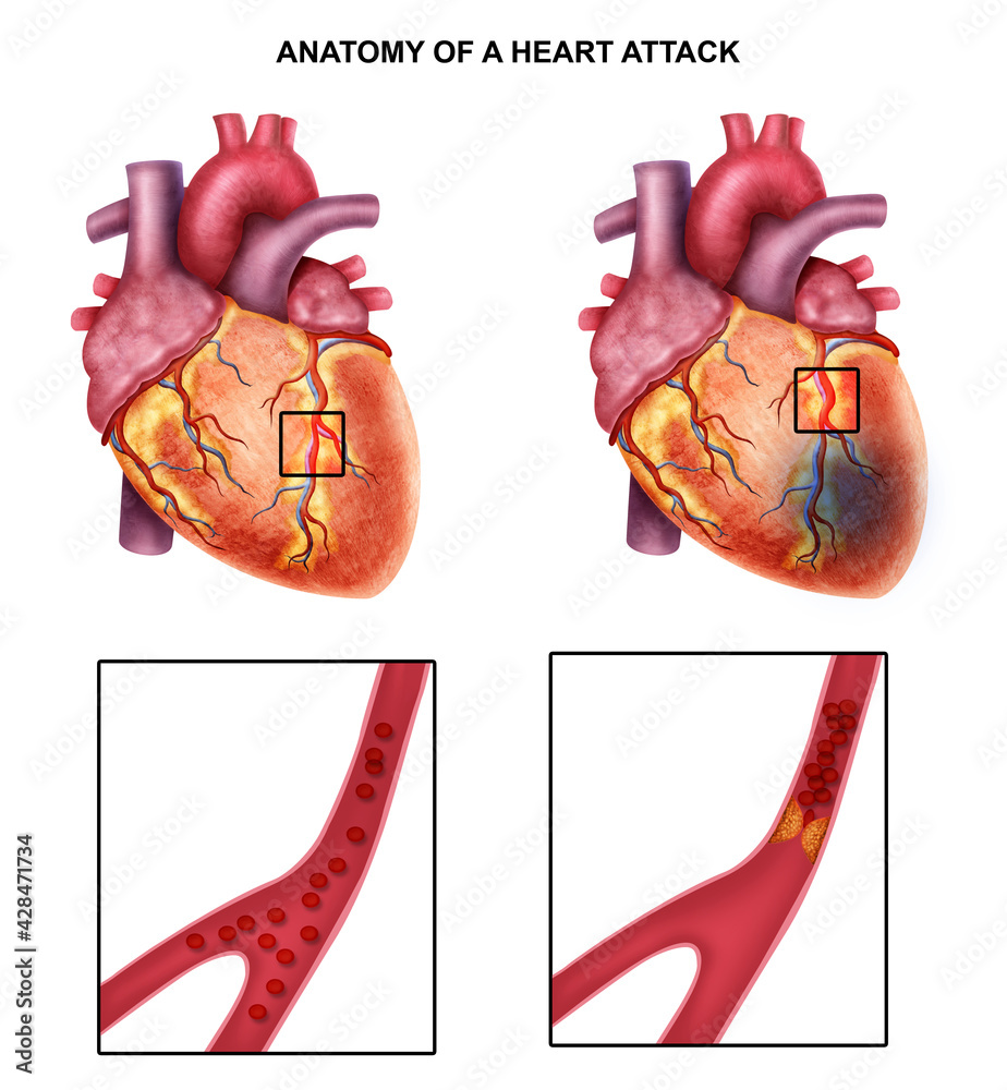 Medical illustration of human Heart anatomy Stock Illustration | Adobe ...
