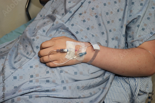 Person on a hospital bed, wearing a gown with an IV in the back of their hand.