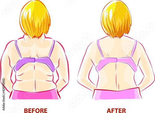 Physical condition developed from health care character design
