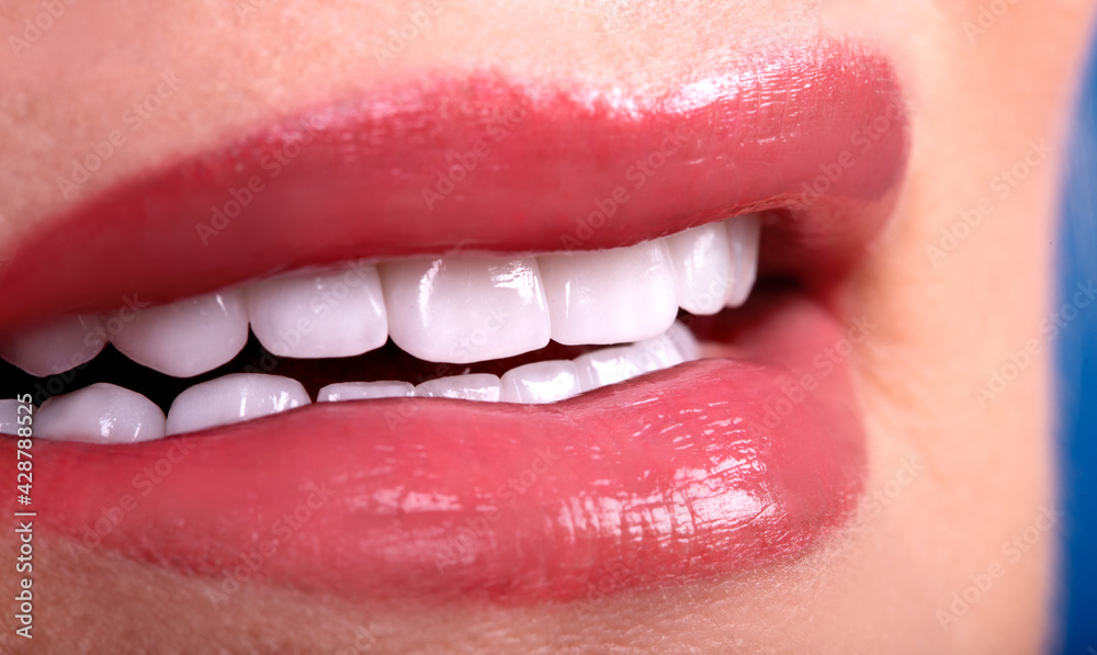 Naklejka premium Perfect Close Up White beautiful Veneers Teeth bleaching crowns whitening young lady smiling, Sensual sexy Seductive plump Lips woman smile. Dental zircon implants restoration surgery. Fashion concept