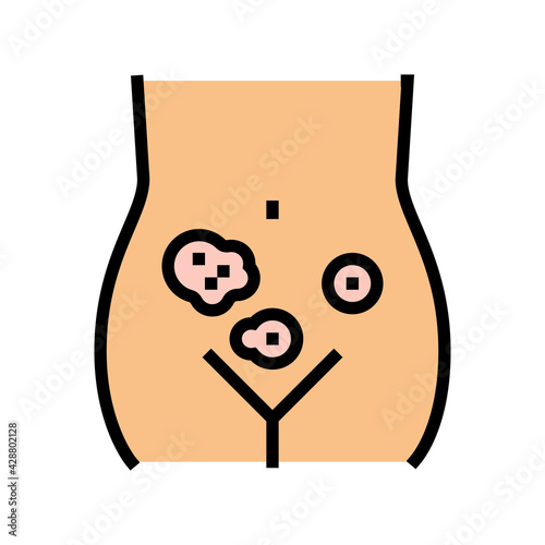 genital dermatology clinic color icon vector. genital dermatology clinic sign. isolated symbol illustration