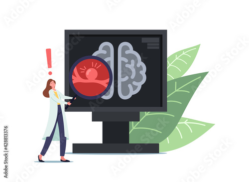 Tiny Doctor Female Character in White Medical Robe Holding Huge Magnifier at Pc Screen with Tomography of Brain Aneurysm