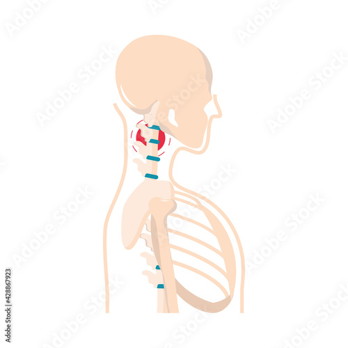 rheumatism arthritis pain