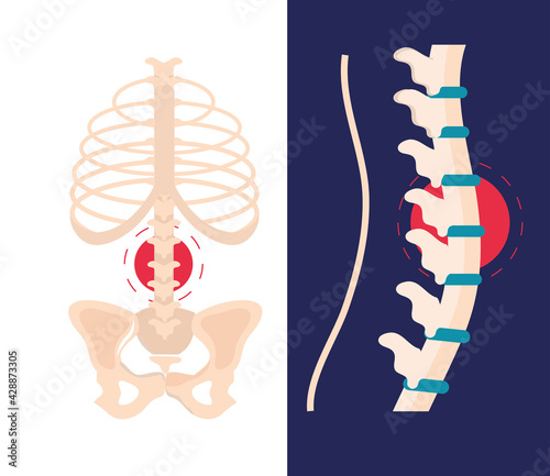arthritis rheumatology spine