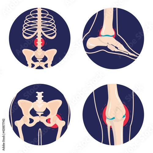 set arthritis rheumatology
