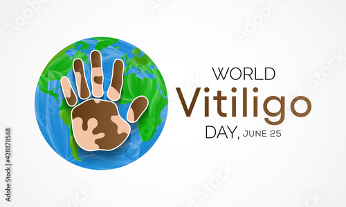 World Vitiligo day is observed every year on June 25, it is a long-term condition where pale white patches develop on the skin. It's caused by the lack of melanin, which is the pigment in skin.
