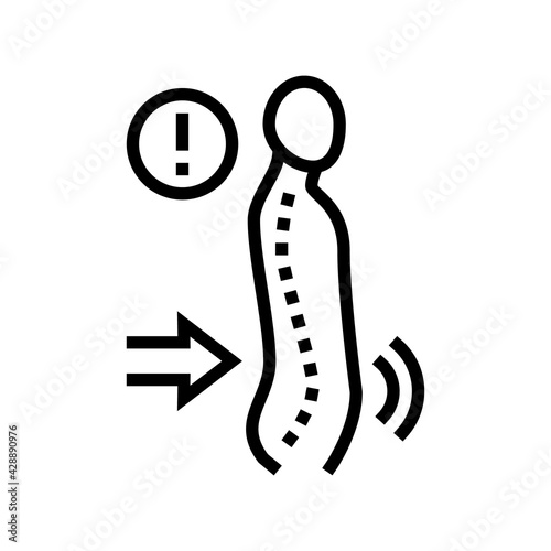 lordosis disease line icon vector. lordosis disease sign. isolated contour symbol black illustration