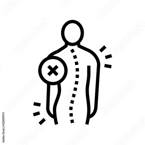 idiopathic scoliosis line icon vector. idiopathic scoliosis sign. isolated contour symbol black illustration