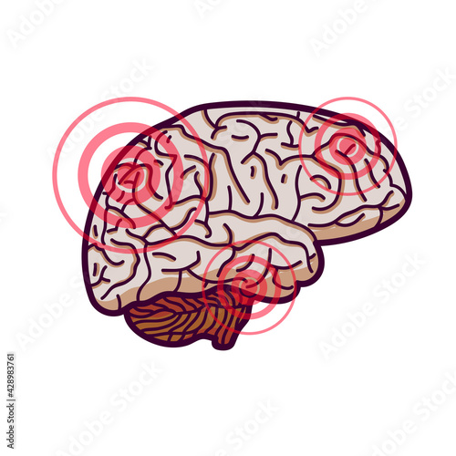 Human brain with pulsating circles of pain.  Isolated on white background.  Headache concept