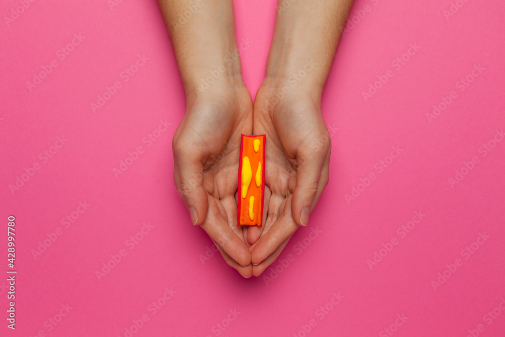 Human vessels model in hands. Treatment of atherosclerosis. Human vessels model in hands. Treatment of atherosclerosis.