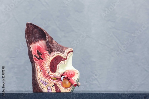 Εκτύπωση καμβά A cutaway plastic model of a sick canine ear