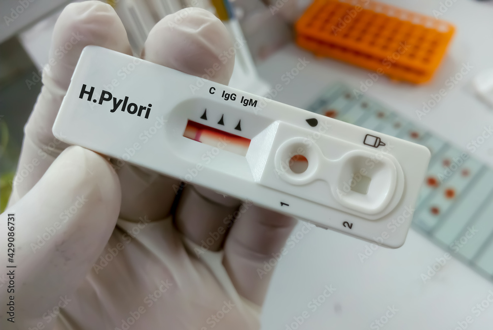 Rapid test cassette for Helicobacter Pylori (H. pylori) testing