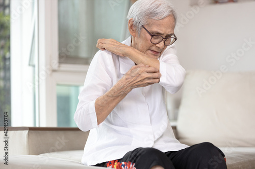 Itchy senior woman is scratching her arm causes of itching from mosquitoes,insect bites or dry itchy skin,old elderly with an itchy rash,female scratching allergic skin,sensitive skin,allergy symptoms