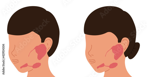 Localization of salivary glands in males and females. Medical vector illustration.