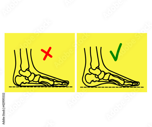 Human leg and joints. Symbol. Vector illustration.
