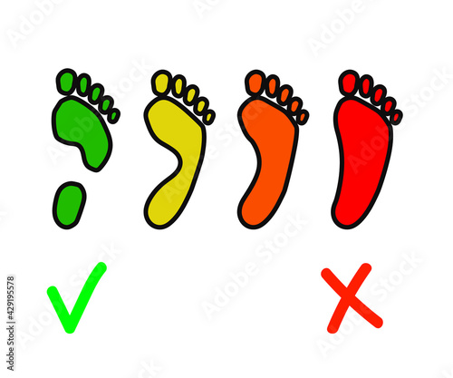 Human footprint. Flat feet. Symbol. Vector illustration.