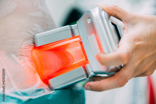 Canvas Print Selective focus image of Cryolipolysis, fat freezing treatment for weight loss