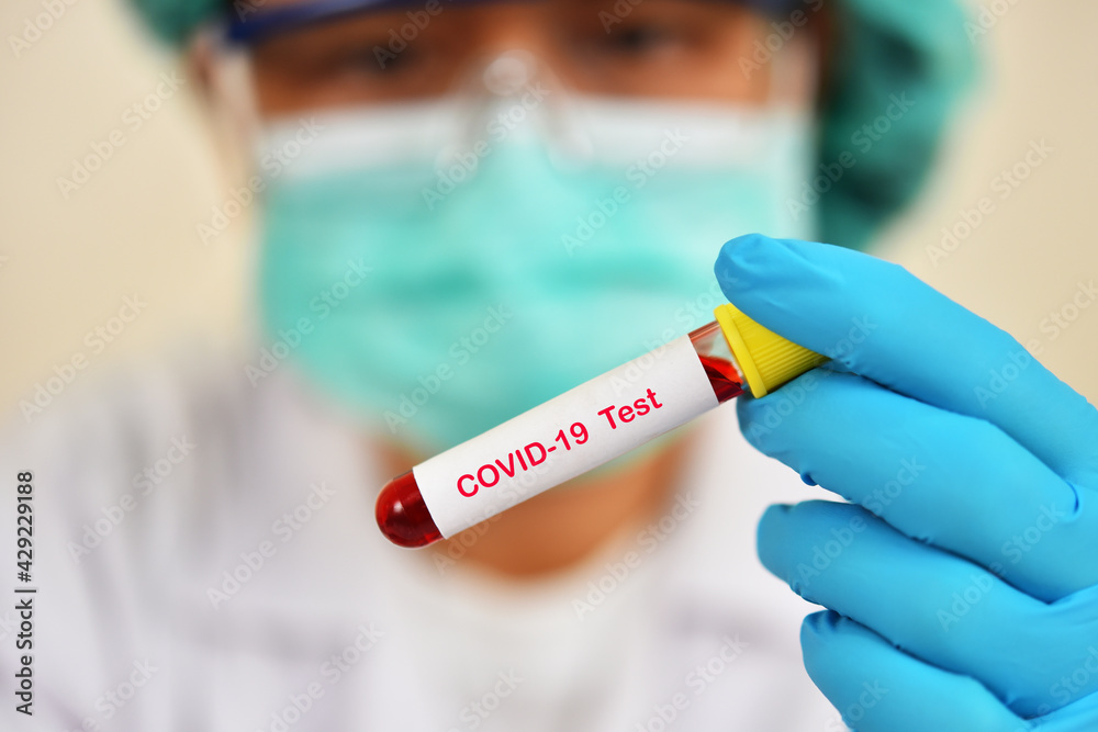 Lab technician holding blood sample tube for COVID-19 test