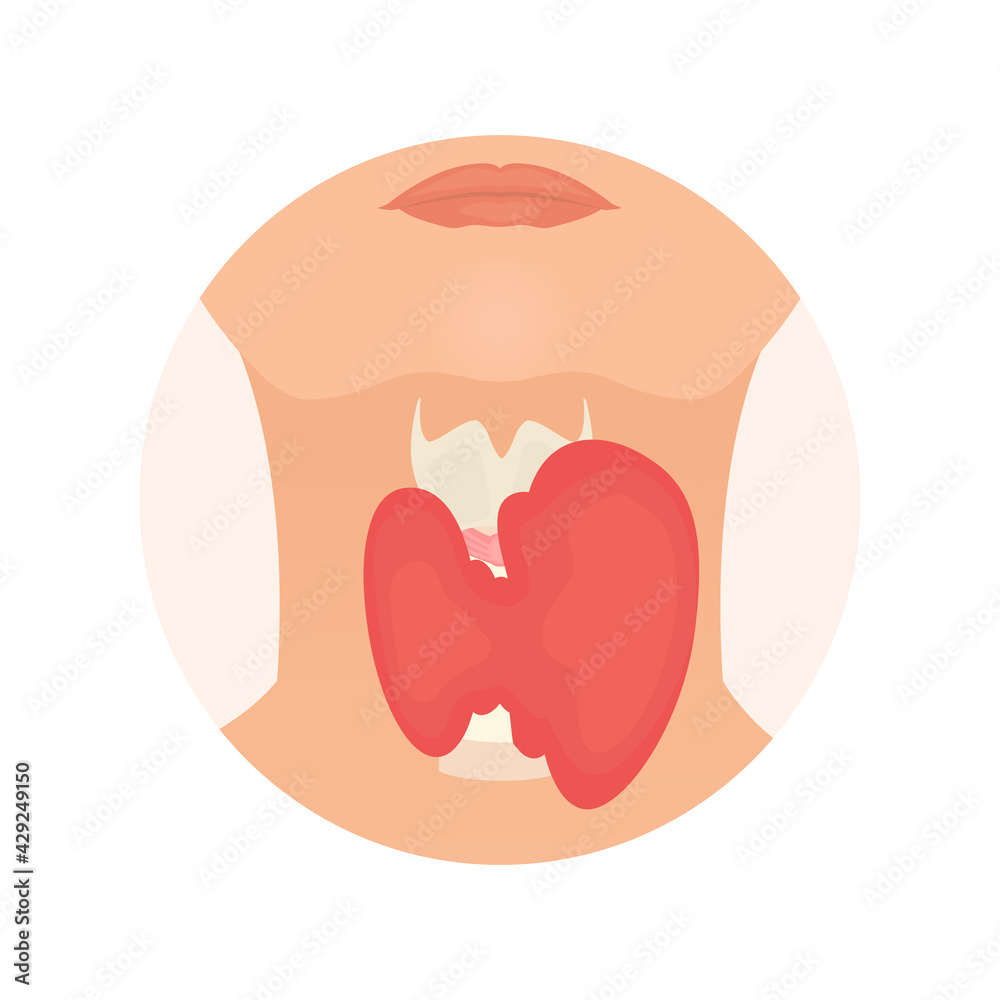 Thyroid gland and trachea shown on a silhouette of a woman. Body anatomy sign. Human endocrine system. Medical internal organ vector illustration. Thyroid gland and trachea shown on a silhouette of a woman. Body anatomy sign. Human endocrine system. Medical internal organ vector illustration.