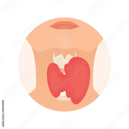 Thyroid gland and trachea shown on a silhouette of a woman. Body anatomy sign. Human endocrine system. Medical internal organ vector illustration.