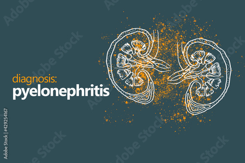 Pyelonephritis, aninflammation of the kidney, typically due to a bacterial infection.
Minimalistic style design template with handrawn organ on grey background photo