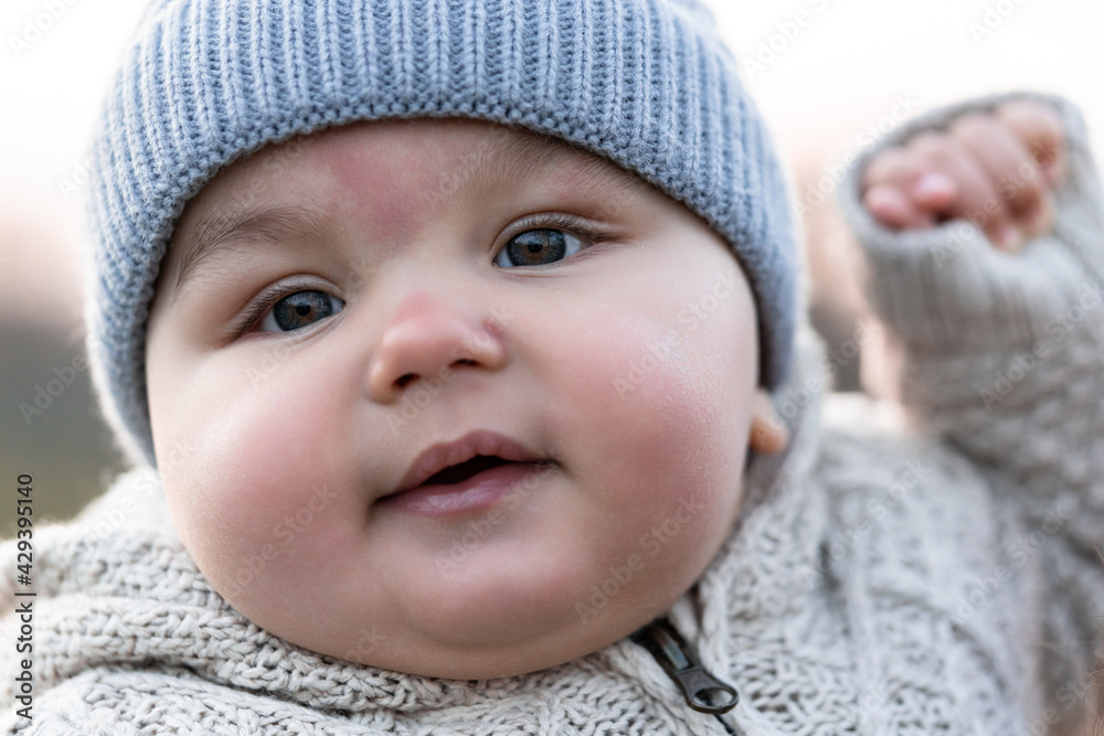 Close-up portrait of a six month old baby outdoors. The baby has red spots on the skin. Close-up portrait of a six month old baby outdoors. The baby has red spots on the skin.