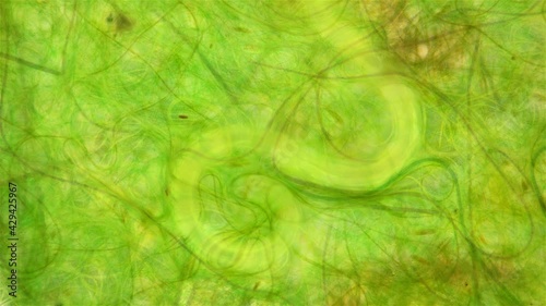 nematoda worm under a microscope, worm movement among algae, widely distributed on the ground, is a parasite, the exact form is not defined
