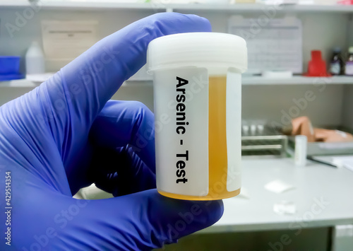 Foto Urine sample for arsenic (heavy metal) test, toxic metal