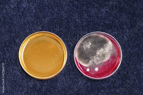 bacterial inoculation in laboratory dishes, grown colonies of bacteria or fungi